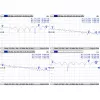 Καλώδιο Mmcx to RPSMA/ACMMCXRPSMA Mikrotik