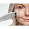 HoMedics MD-1000-EU2 Συσκευή περιποίησης δέρματος Μικροδερμοαπόξεση με κενό αέρος Λευκό